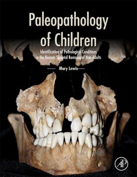 Paleopathology of Children