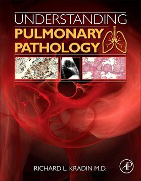 Understanding Pulmonary Pathology