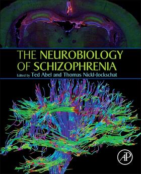 Neurobiology of Schizophrenia