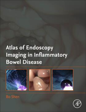 Atlas of Endoscopy Imaging in Inflammatory Bowel Disease