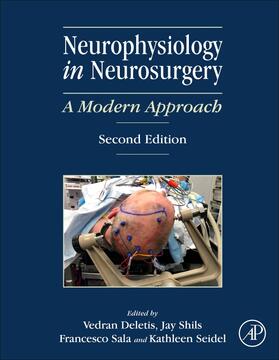 NEUROPHYSIOLOGY IN NEUROSURGER