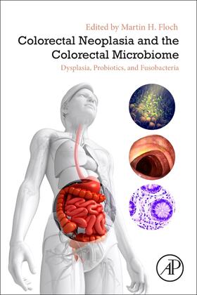 COLORECTAL NEOPLASIA & THE COL