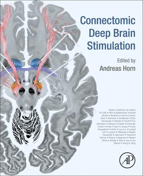 Connectomic Deep Brain Stimulation