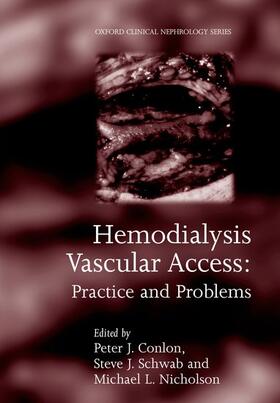 HEMODIALYSIS VASCULAR ACCESS R