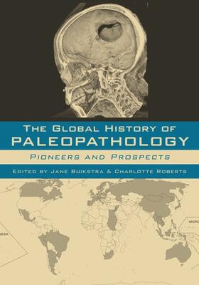 GLOBAL HIST OF PALEOPATHOLOGY