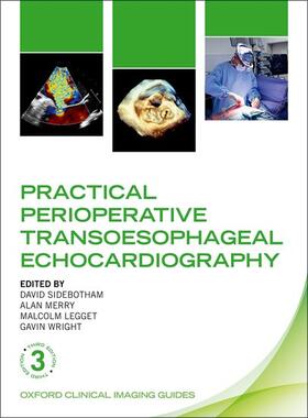 Practical Perioperative Transoesophageal Echocardiography