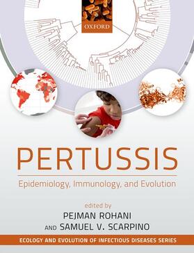 Pertussis