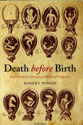 DEATH BEFORE BIRTH