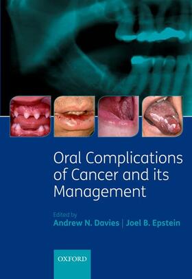 ORAL COMPLICATIONS OF CANCER &