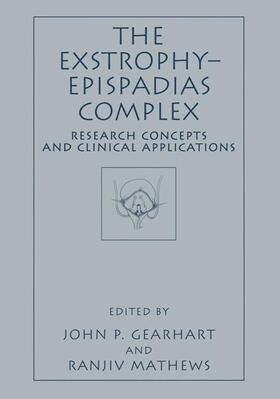 The Exstrophy¿Epispadias Complex