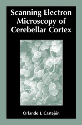 Scanning Electron Microscopy of Cerebellar Cortex