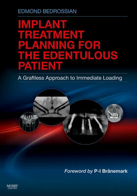 Bedrossian, E: Implant Treatment Planning for the Edentulous
