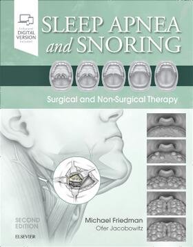 SLEEP APNEA & SNORING 2/E