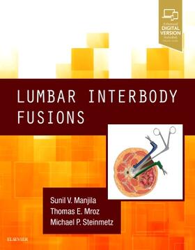 LUMBAR INTERBODY FUSIONS