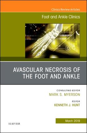AVASCULAR NECROSIS OF THE FOOT