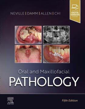 ORAL & MAXILLOFACIAL PATHOLOGY