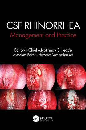 CSF Rhinorrhoea