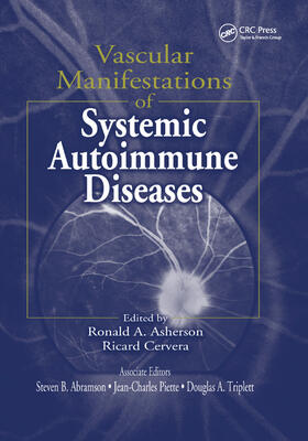 Vascular Manifestations of Systemic Autoimmune Diseases