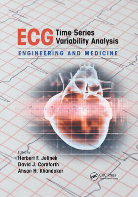 ECG Time Series Variability Analysis