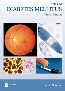 Atlas of Diabetes Mellitus