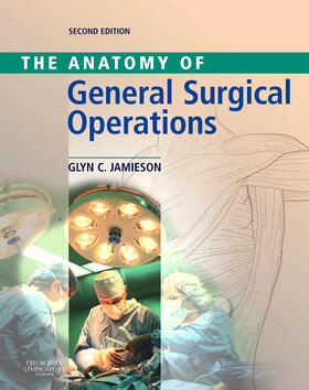 Anatomy of General Surgical Operations