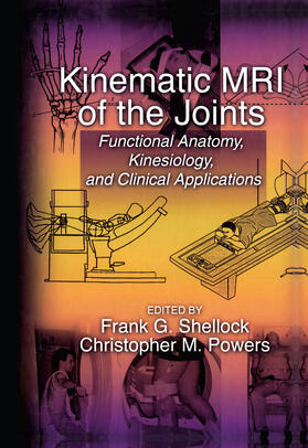 Kinematic MRI of the Joints