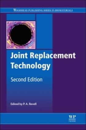 Joint Replacement Technology