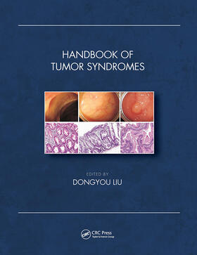 HANDBK OF TUMOR SYNDROMES