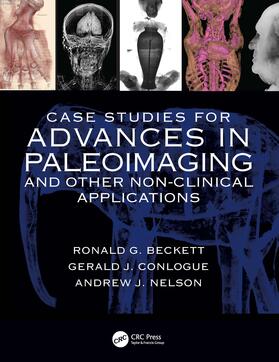 Nelson, A: Case Studies for Advances in Paleoimaging and Oth