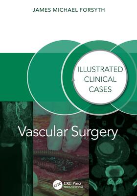 Vascular Surgery: