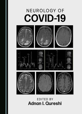 Neurology of COVID-19