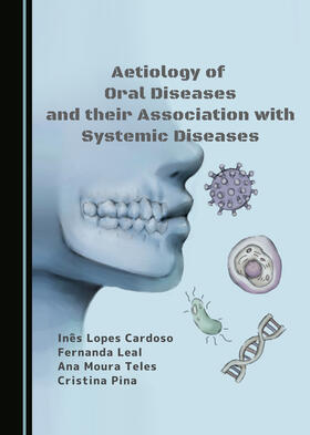 Aetiology of Oral Diseases and their Association with Systemic Diseases