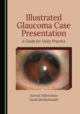 Illustrated Glaucoma Case Presentation