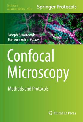 Confocal Microscopy