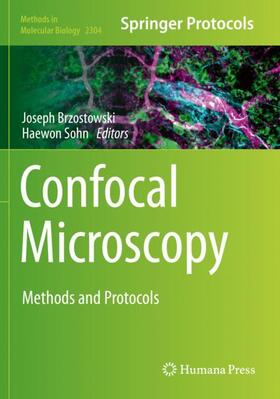 Confocal Microscopy