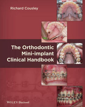 Orthodontics Mini Implant Clin