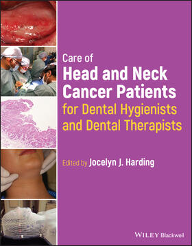 Care of Head and Neck Cancer Patients for Dental Hygienists