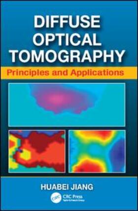 Diffuse Optical Tomography