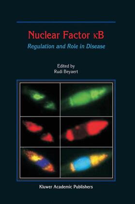Nuclear Factor &#1082;b