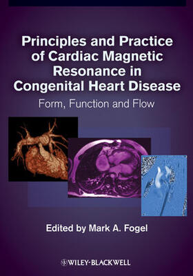 Principles and Practice of Cardiac Magnetic Resonance in Congenital Heart Disease: Form, Function, and Flow