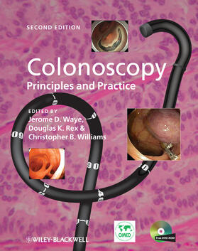 Colonoscopy