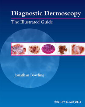 Bowling: Diagnostic Dermoscopy