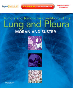 Tumors and Tumor-like Conditions of the Lung and Pleura