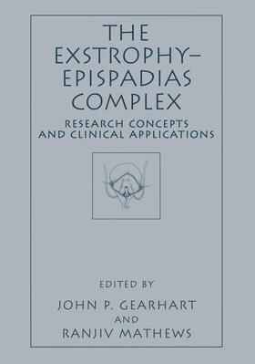 The Exstrophy¿Epispadias Complex