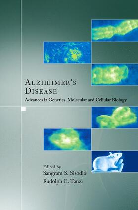 Alzheimer's Disease