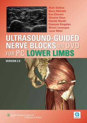 Ultrasound-Guided Nerve Blocks on DVD Vs 2.0: Lower Limbs for PC