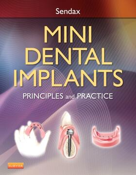 Sendax, V: Mini Dental Implants