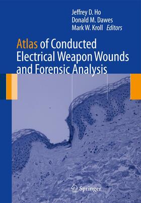 Atlas of Conducted Electrical Weapon Wounds and Forensic Analysis