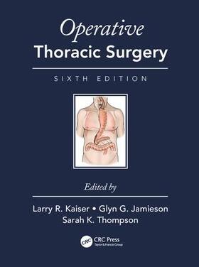 Operative Thoracic Surgery