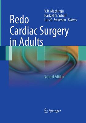 Redo Cardiac Surgery in Adults